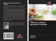 Bookcover of Rilievo in protesi parziale in fusione