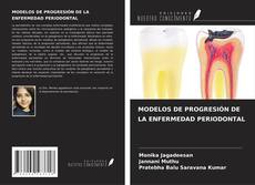 Обложка MODELOS DE PROGRESIÓN DE LA ENFERMEDAD PERIODONTAL
