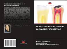 MODÈLES DE PROGRESSION DE LA MALADIE PARODONTALE的封面