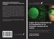 Bookcover of Lugar de la evaluación de la trombofilia en la oclusión venosa de la retina