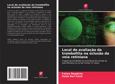 Buchcover von Local de avaliação da trombofilia na oclusão da veia retiniana