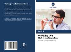 Bookcover of Wartung von Zahnimplantaten