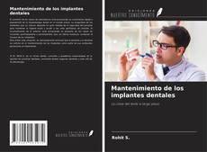 Bookcover of Mantenimiento de los implantes dentales