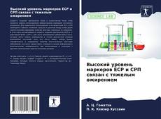 Buchcover von Высокий уровень маркеров ЕСР и CРП связан с тяжелым ожирением