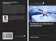 Buchcover von Control de la infección en prostodoncia