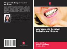 Bookcover of Alargamento Gengival Induzido por Drogas