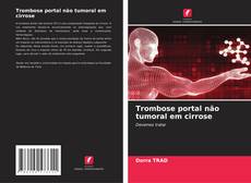 Buchcover von Trombose portal não tumoral em cirrose