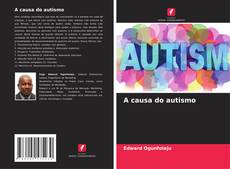 Couverture de A causa do autismo