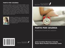 Buchcover von PARTO POR CESÁREA