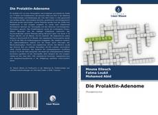Couverture de Die Prolaktin-Adenome