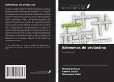 Bookcover of Adenomas de prolactina