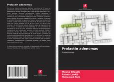 Capa do livro de Prolactin adenomas 