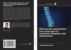 Buchcover von Eficacia del tratamiento con corsé para la escoliosis idiopática del adolescente