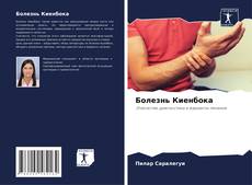 Borítókép a  Болезнь Киенбока - hoz