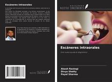 Bookcover of Escáneres intraorales