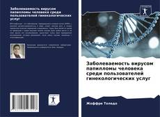 Buchcover von Заболеваемость вирусом папилломы человека среди пользователей гинекологических услуг