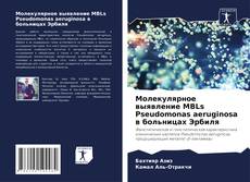 Молекулярное выявление MBLs Pseudomonas aeruginosa в больницах Эрбиля的封面