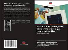 Bookcover of Efficacité de l'analgésie péridurale thoracique haute préventive