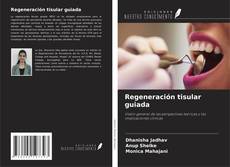 Bookcover of Regeneración tisular guiada