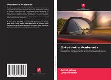 Capa do livro de Ortodontia Acelerada 