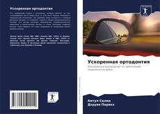 Buchcover von Ускоренная ортодонтия