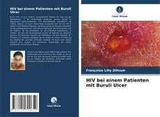 Copertina di HIV bei einem Patienten mit Buruli Ulcer
