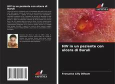 Buchcover von HIV in un paziente con ulcera di Buruli