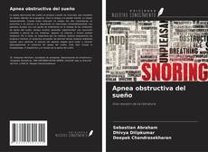 Bookcover of Apnea obstructiva del sueño