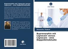 Portada del libro de Buprenorphin mit Lignocain versus Lignocain - eine Doppelblindstudie
