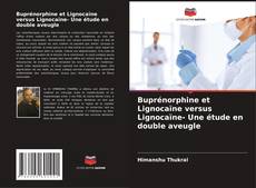 Buchcover von Buprénorphine et Lignocaïne versus Lignocaïne- Une étude en double aveugle