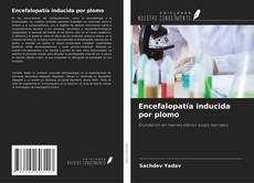 Bookcover of Encefalopatía inducida por plomo
