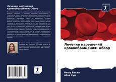 Borítókép a  Лечение нарушений кровообращения: Обзор - hoz