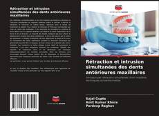 Buchcover von Rétraction et intrusion simultanées des dents antérieures maxillaires