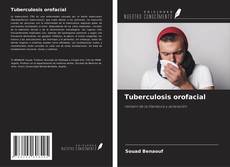 Bookcover of Tuberculosis orofacial