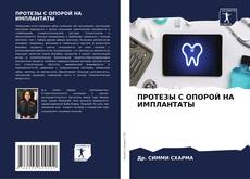 Buchcover von ПРОТЕЗЫ С ОПОРОЙ НА ИМПЛАНТАТЫ
