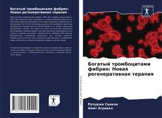 Buchcover von Богатый тромбоцитами фибрин: Новая регенеративная терапия