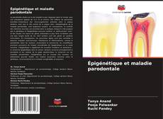 Buchcover von Épigénétique et maladie parodontale