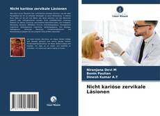 Buchcover von Nicht kariöse zervikale Läsionen