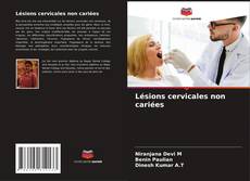 Buchcover von Lésions cervicales non cariées