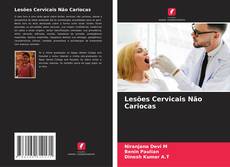 Lesões Cervicais Não Cariocas的封面