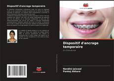 Bookcover of Dispositif d'ancrage temporaire