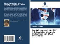 Обложка Die Wirksamkeit des GLP-1R-Agonisten Liraglutid im Rahmen von ERAS-Protokollen
