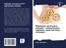 Перекрут желчного пузыря - клиническая картина, диагностика, лечение的封面