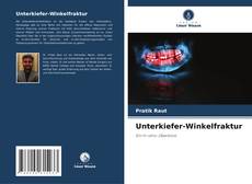 Buchcover von Unterkiefer-Winkelfraktur