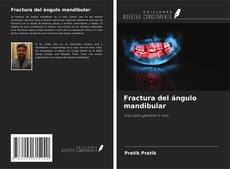 Bookcover of Fractura del ángulo mandibular