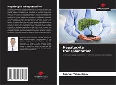 Copertina di Hepatocyte transplantation