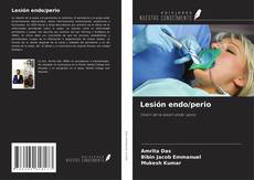 Lesión endo/perio kitap kapağı