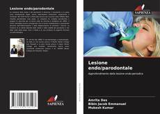 Borítókép a  Lesione endo/parodontale - hoz