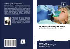 Copertina di Эндо/перио поражение