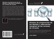 Diseños de preparación de los dientes y adecuación marginal de las coronas de circonio kitap kapağı